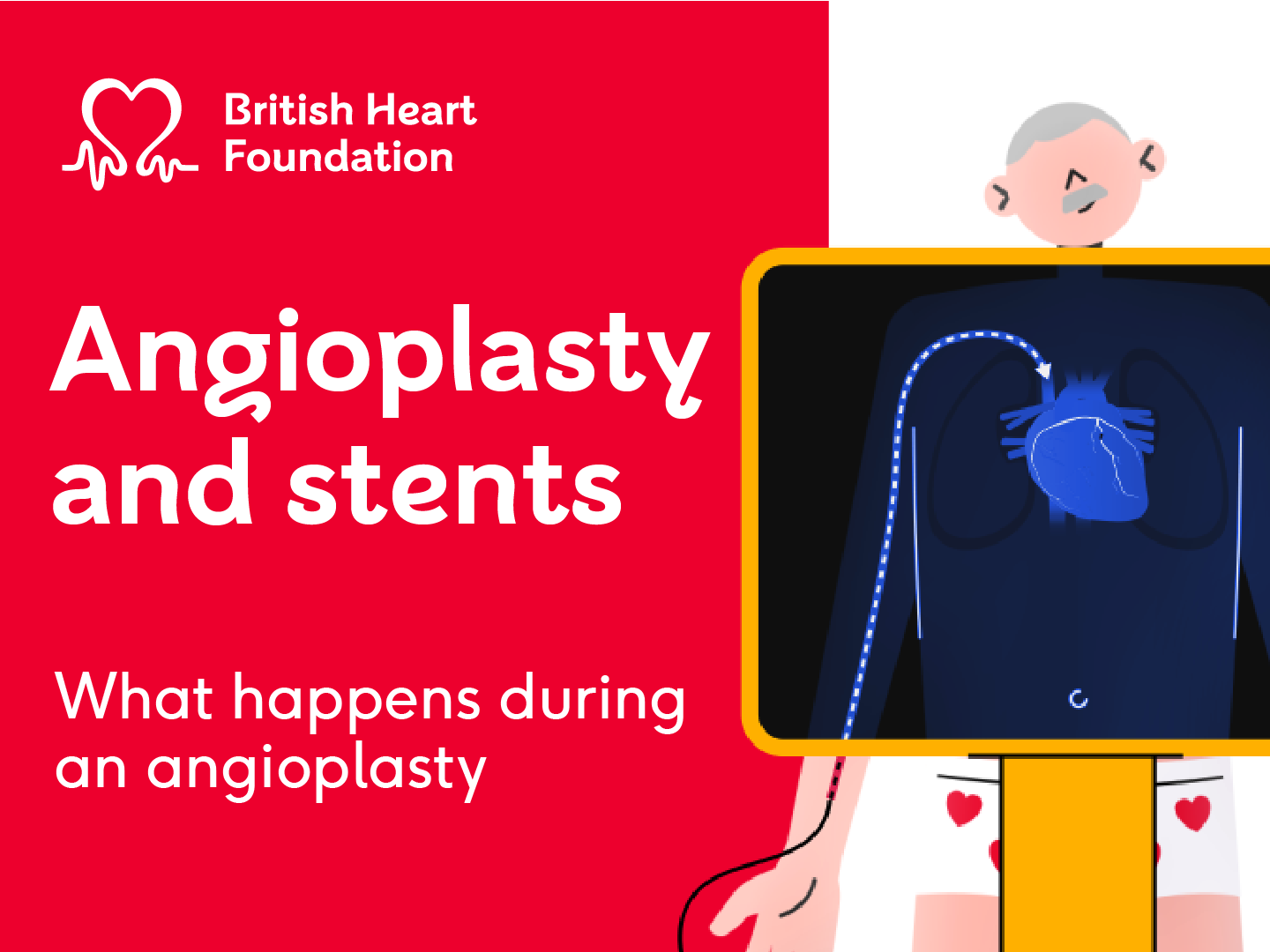 On the left side of the image is a red background with the British Heart Foundation logo and text that reads angioplasty and stents what happens during an angioplasty. On the right is a white background showing an illustration of a white man with grey hair and a moustache with an X-ray machine over his heart.
