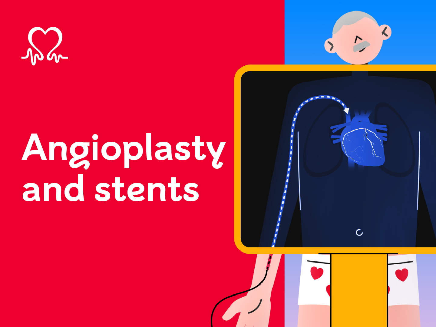 Illustrated man with grey hair and a moustache on the right side of the image. X-ray machine over his chest shows an outline of his heart in blue. On the left is a red background with white text that reads Angioplasty and stents