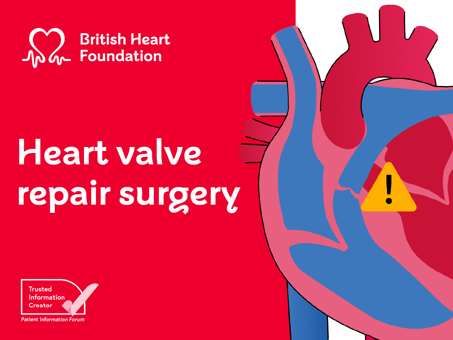 Illustration of a heart on the right hand side of the image, the left hand side has a red background with a BHF logo in the top left and text overlaid saying Heart valve repair surgery