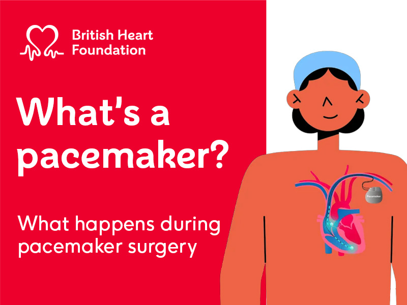 White text on red background reading "What's a pacemaker? What happens during pacemaker surgery". With illustration of a patient with a pacemaker.
