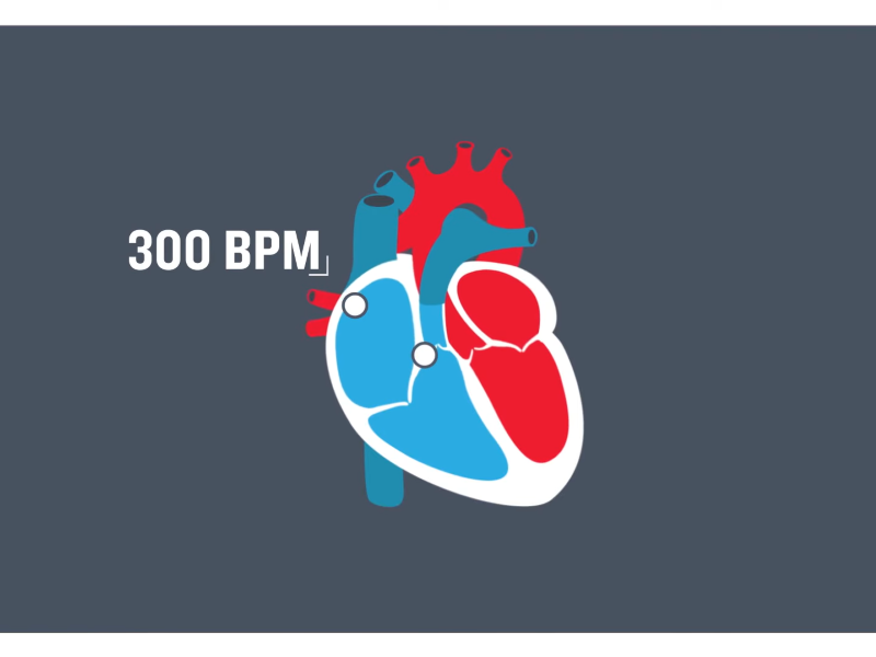 An illustration of a heart with the text "300 BPM"