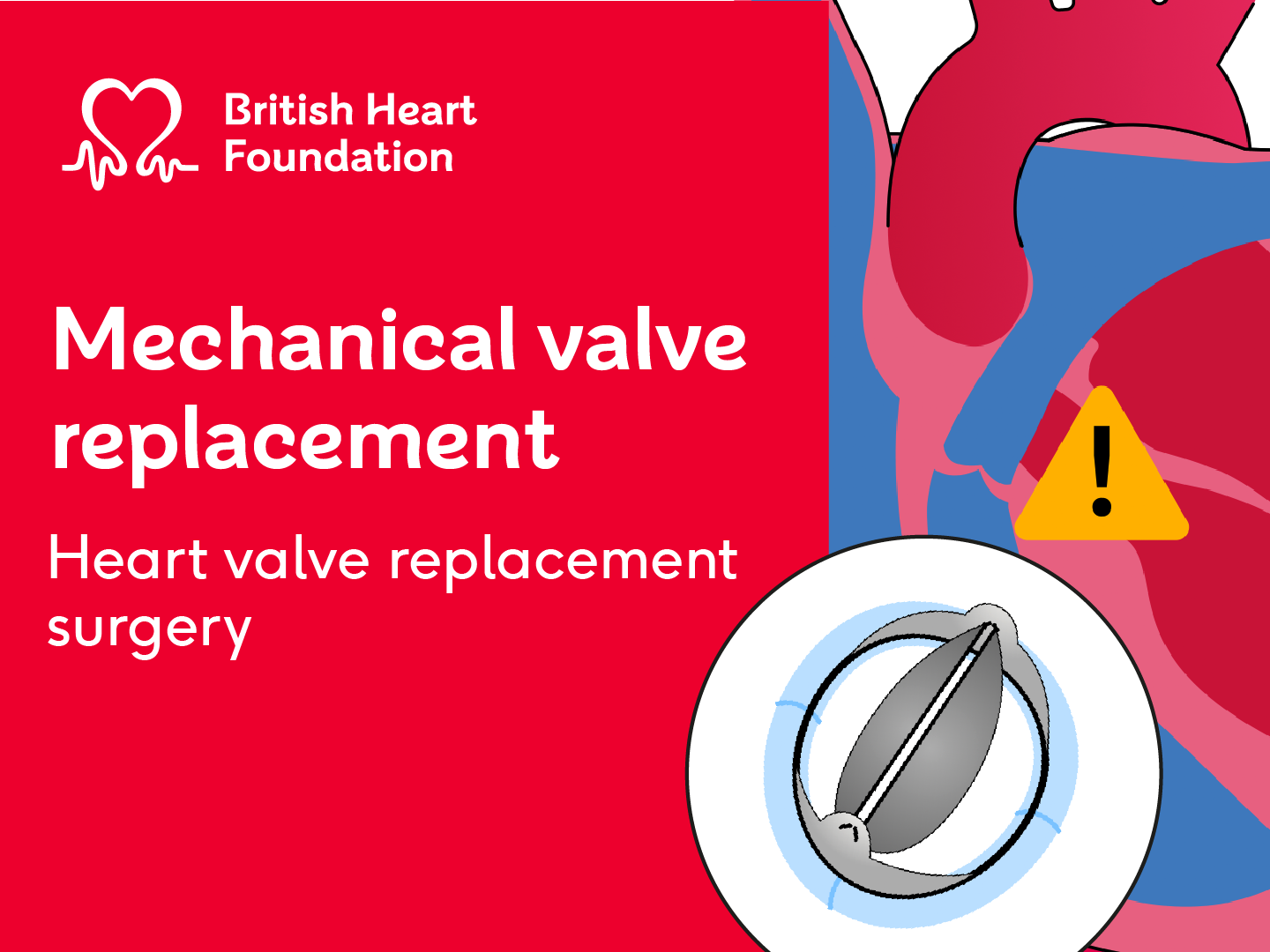 A red background with the white British Heartv Foundation logo in the top left. On the right hand side is an illustration of a heart with a faulty heart valve. There is also a picture of a mechanical heart valve over the top of the heart. On the left hand side it says Mechanical heart valve replacement: Heart valve replacement surgery