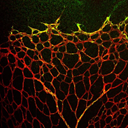 Growing blood vessels in red and green