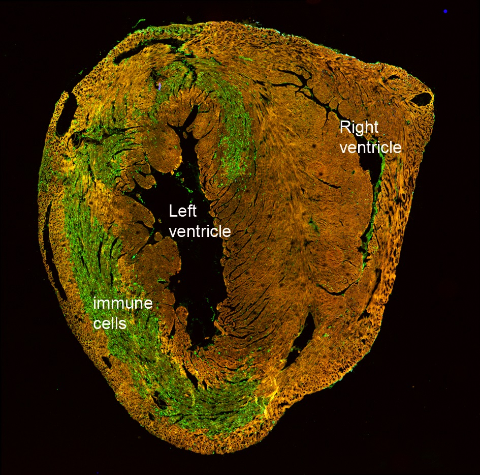 Immune cells accumulate in injured heart