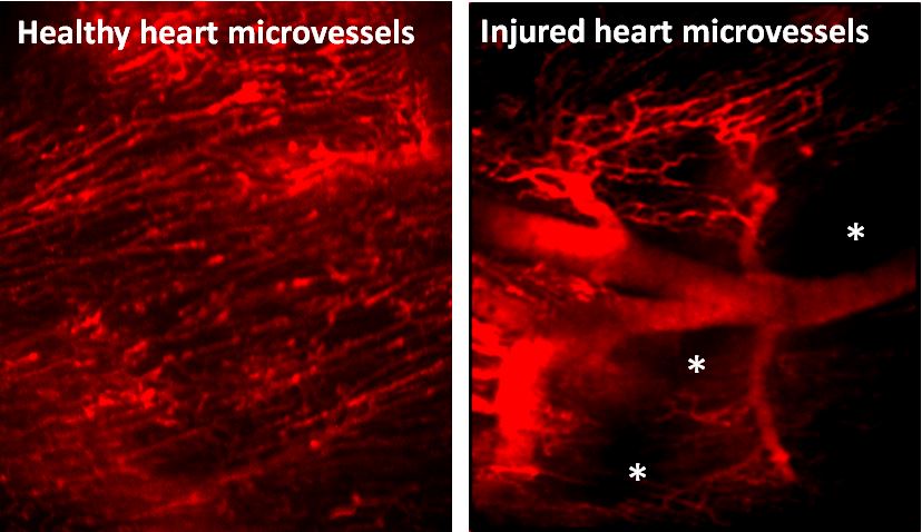 Microscopy images showing microvessels in the heart