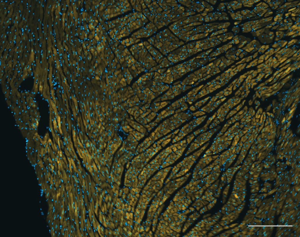 A tissue sample scan showing areas of DNA.