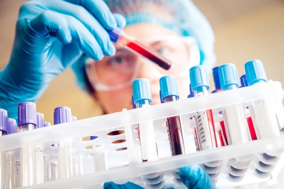 Researcher looking at tubes of blood in a rack
