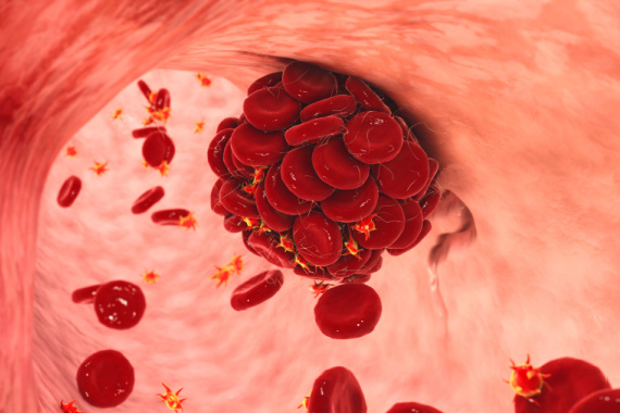 blood cells