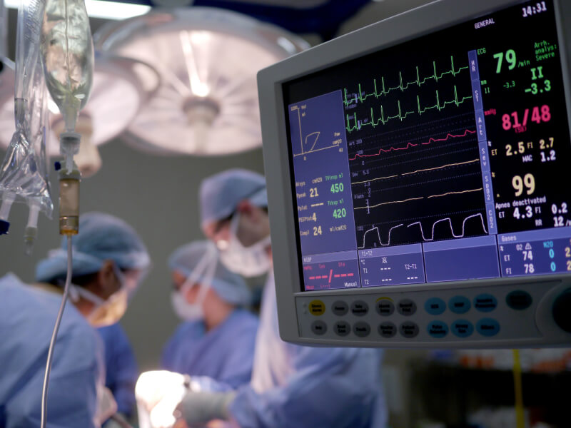 A cardiac monitor inside a surgery room, with surgeons operating on a patient 