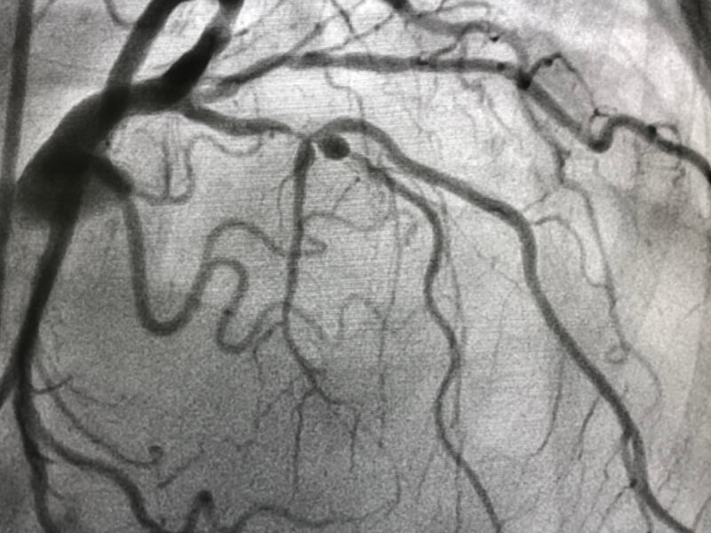Blood vessels on a medical scan