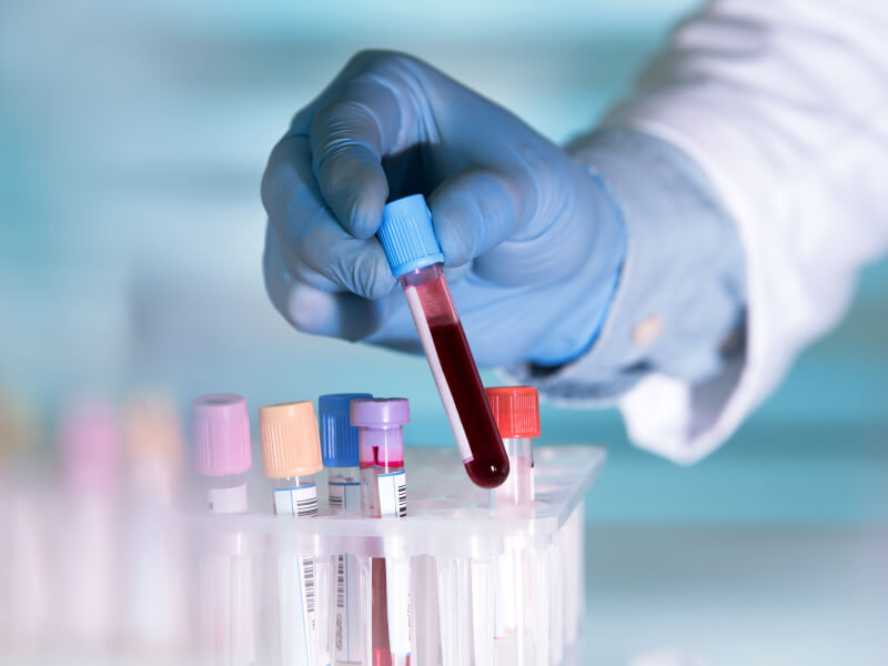 A researcher wearing a blue glove places a test tube of blood onto a desk
