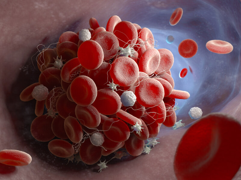 Graphic of blood vessels