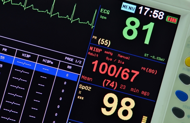 heart monitor