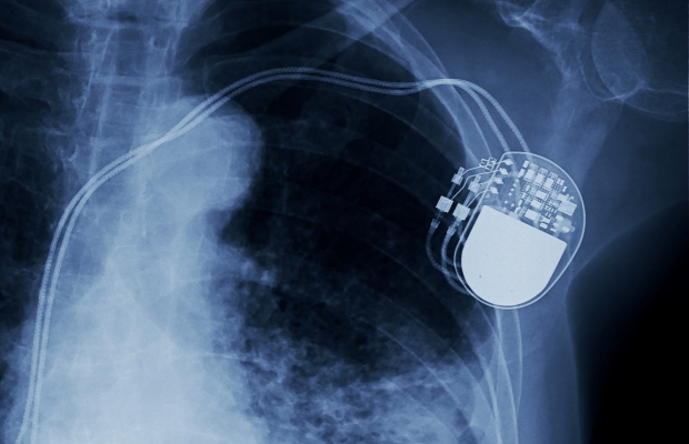 pacemaker