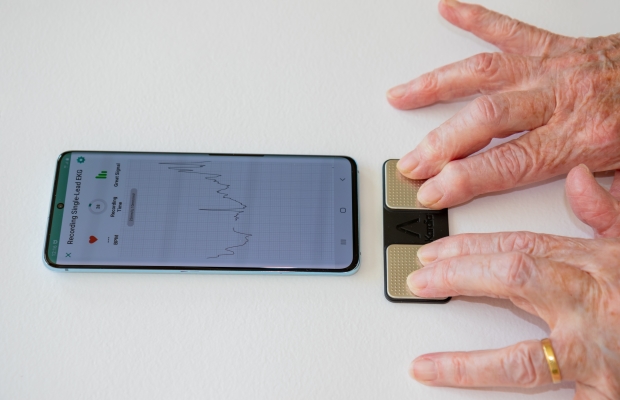 smartphone ecg