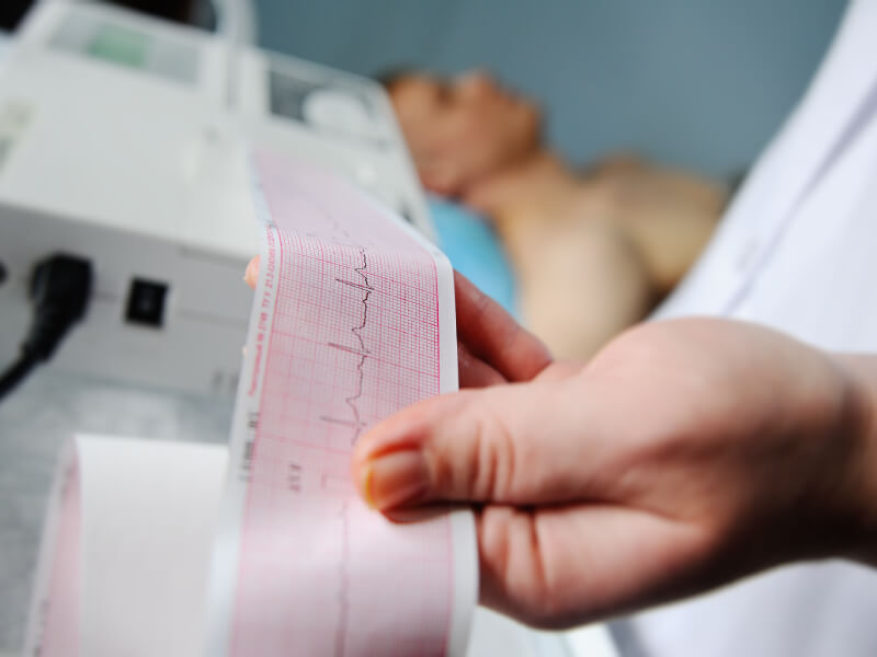 Doctor holding ECG paper and a patient is lying down on an examination bed in the background