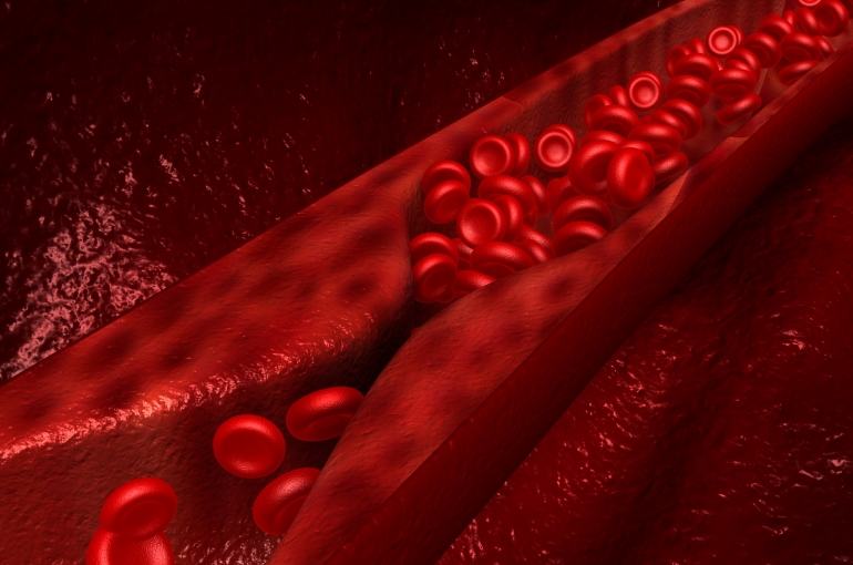 Stopping the damage that diabetes causes to arteries and veins BHF