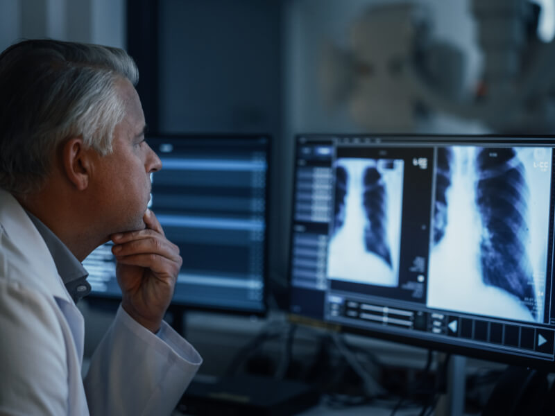 Doctor looking at a scan of a chest on a computer in a dark room