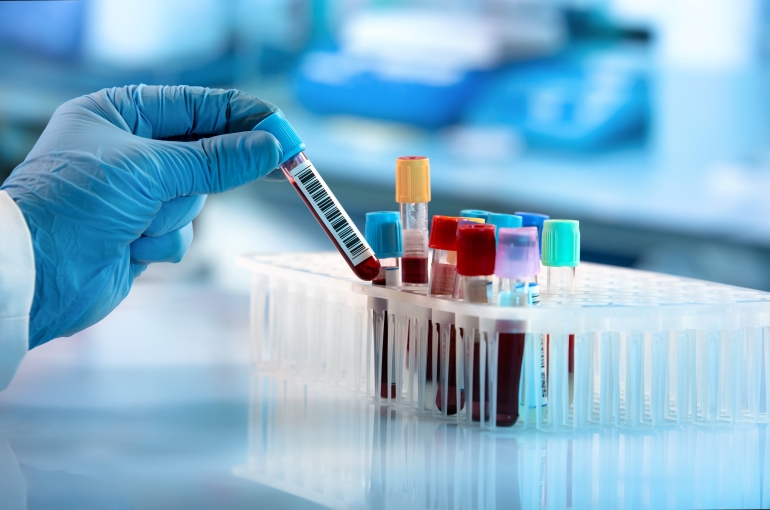 hand picking test tube