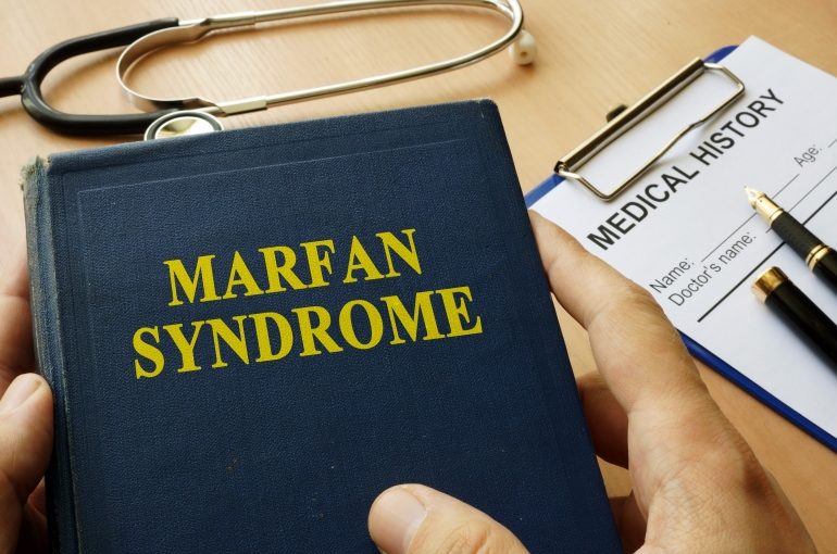 Marfan syndrome textbook