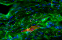 Green and red heart cells seen under a microscope