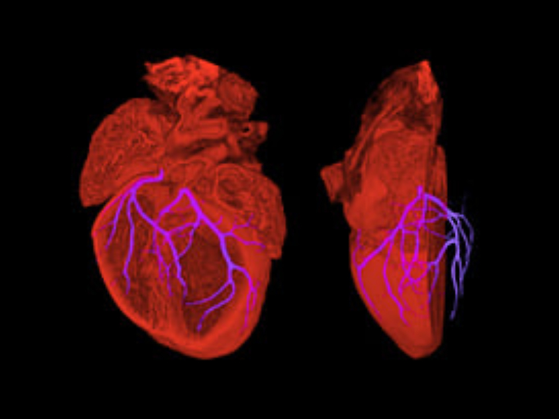 Scientific image of an embryo heart