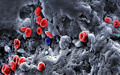 A detailed view of a blood clot