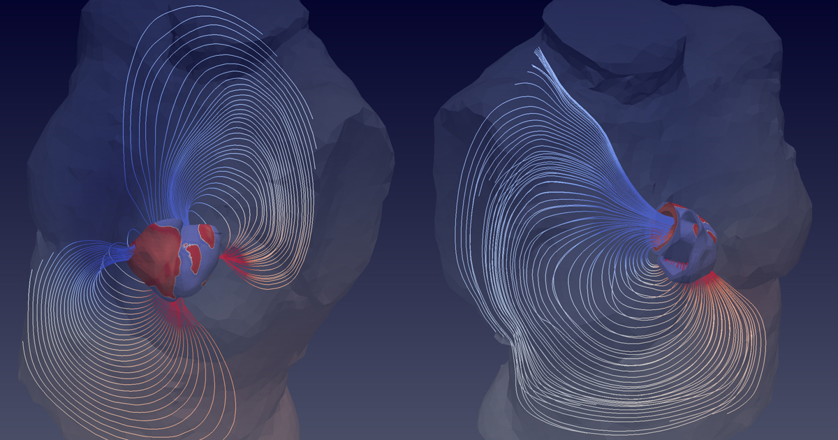 Computer images showing electrical activity in a healthy heart, left, and an unhealthy one, right.