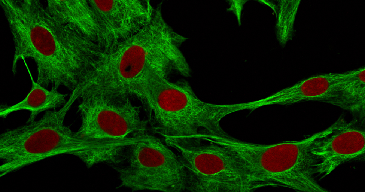 An image of human myofibroblasts growing in a dish. They have been stained with fluorescent molecules to showy the nuclei in red, and the cell body in green.