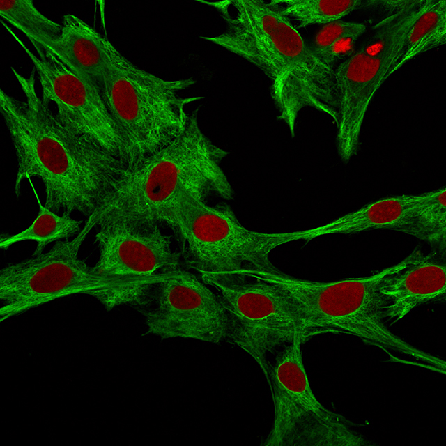 An image of human myofibroblasts growing in a dish.