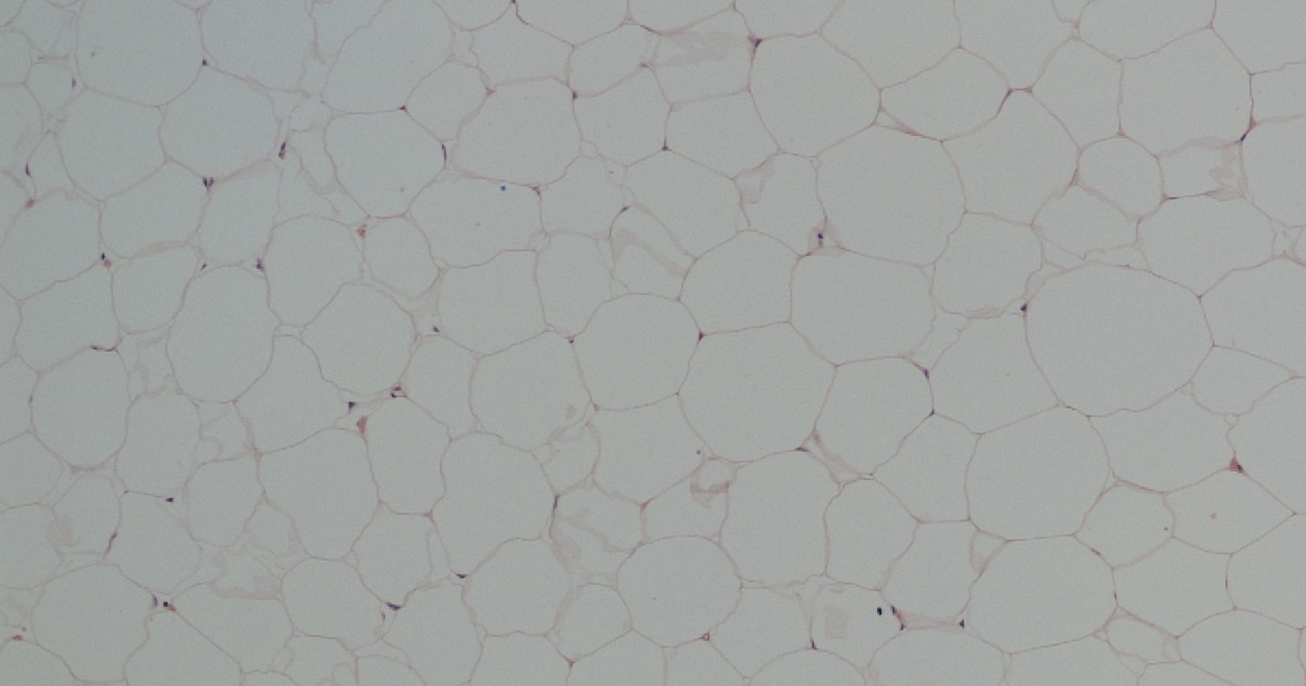 An image of abdominal fat cells 