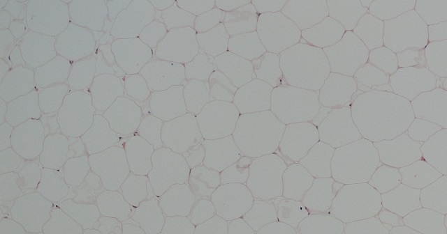 Fat cells in the body