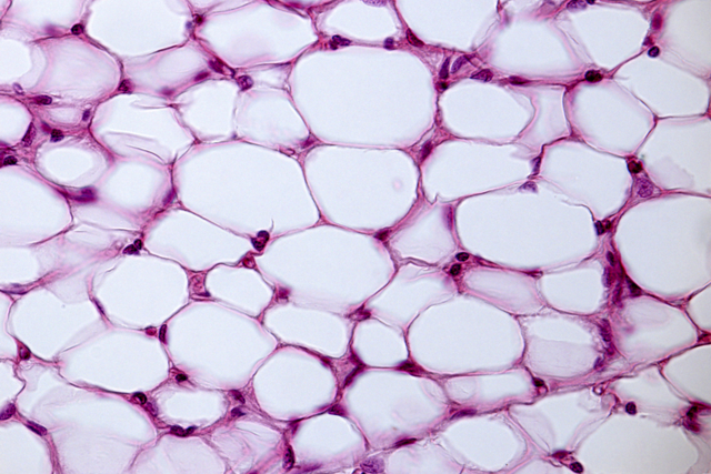 Fat cells on microscope slide