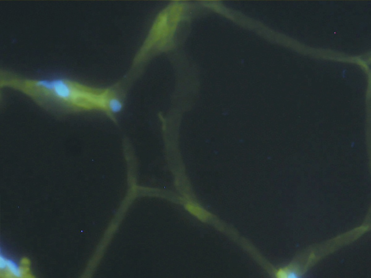 An image of a fat cell