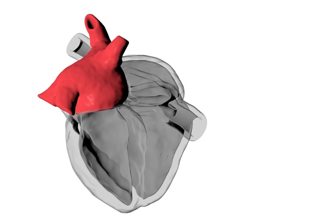 Computational model of the human heart