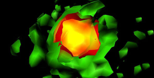 TPC2 ion channel seen using confocal microcsopy