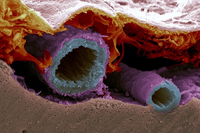 A cross-section of subarachnoid blood vessels