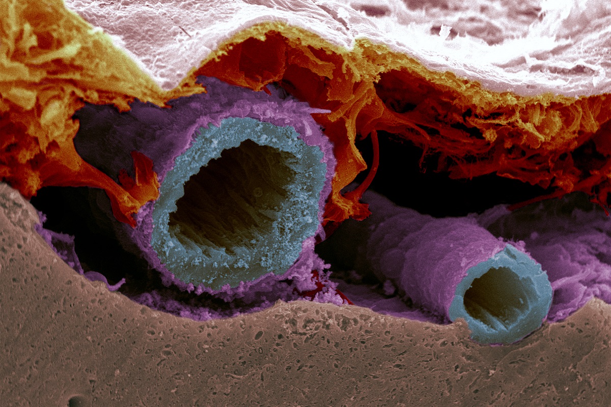Blood vessels in the brain
