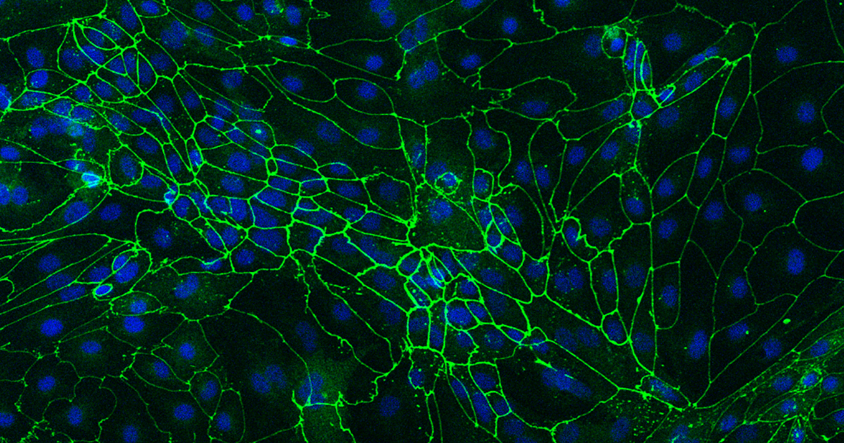 Epicardial cells help the development of the heart.