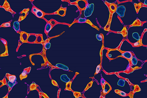 This colourful image shows the web-like network of ‘microvessels’ found in the heart.