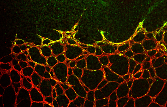 Blood vessels from a mouse retina
