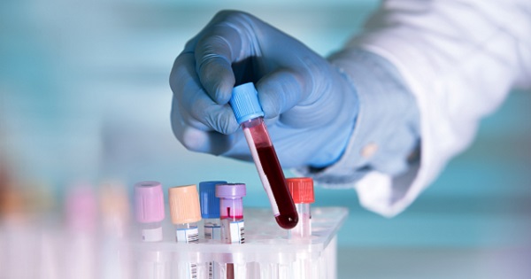 Laboratory blood test
