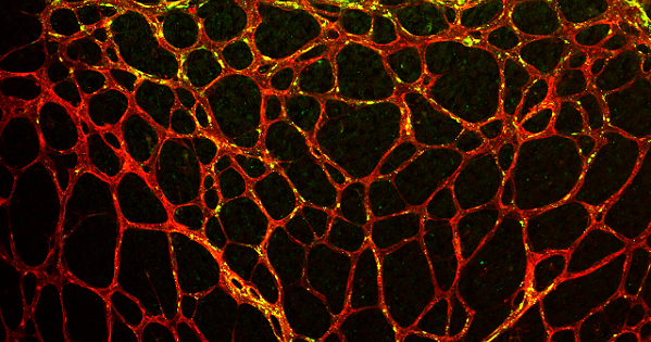 Blood vessels from a mouse retina