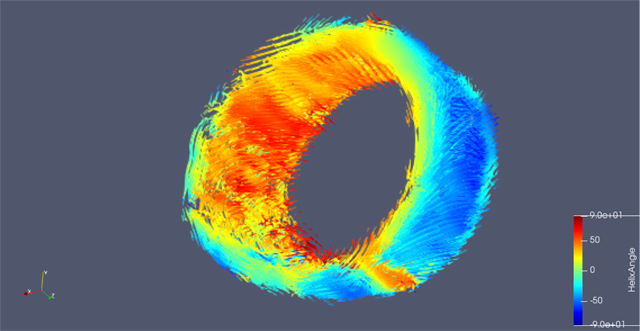 A scan showing a cross section of the left ventricle using Diffusion Tensor Imaging.