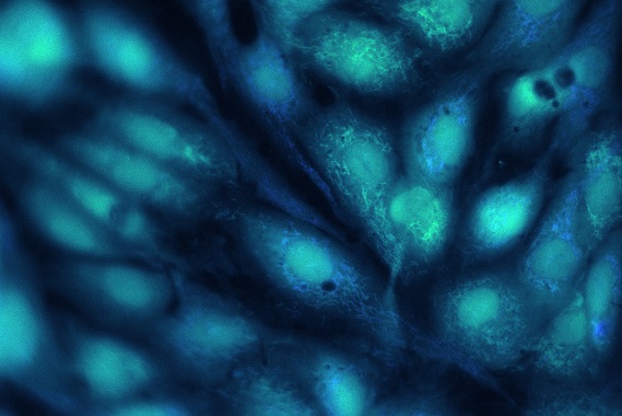 An image of endothelial cells under a microscope. The cells are elliptical in shape and appear as a blue green colour.