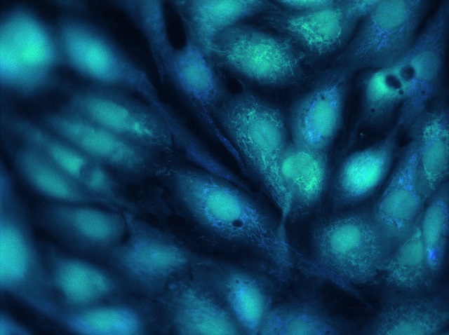 An image of endothelial cells under a microscope. The cells are elliptical in shape and appear as a blue green colour.