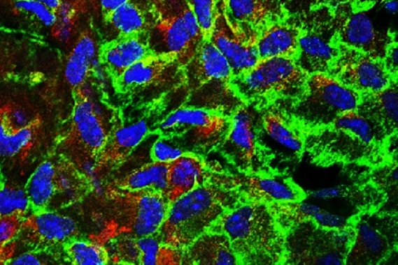 An image from a microscope highlighting a protein called c-Rel, in part of the aorta.