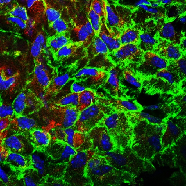 An image from a microscope highlighting a protein called c-Rel, in part of the aorta. 