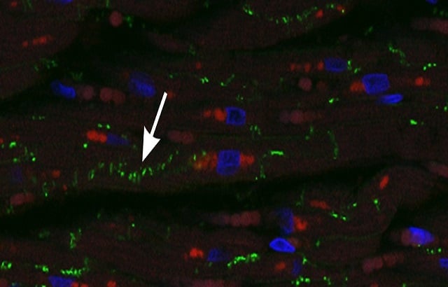 A micrograph showing a biological sample labeled with fluorescent markers