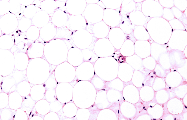 Fat tissue stained in lab